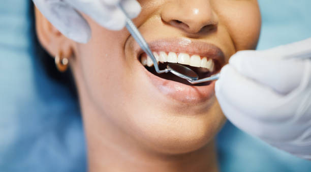 Best Emergency Root Canal Treatment in Cherryvale, SC